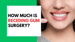 How Much is Receding Gum Surgery
