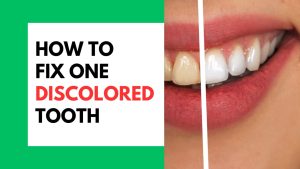 How To Fix One Discolored Tooth
