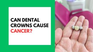 Can Dental Crowns Cause Cancer