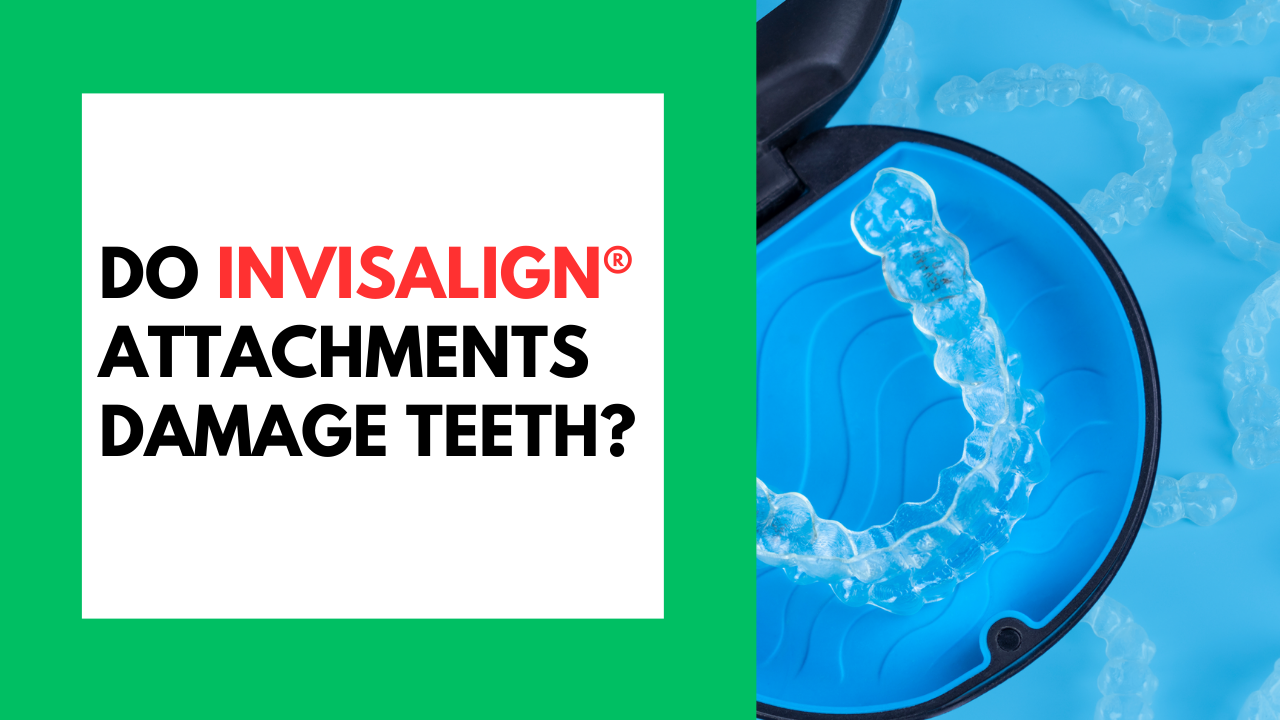 Do Invisaligh Damage Teeth