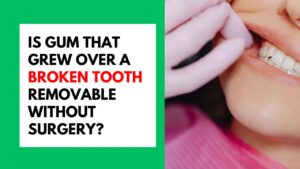 Is Gum That Grew Over a Broken Tooth Removable Without Surgery