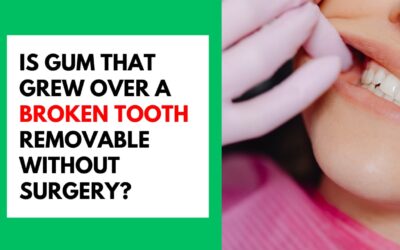 Is Gum That Grew Over a Broken Tooth Removable Without Surgery? Is Gum That Grew Over a Broken Tooth Removable Without Surgery