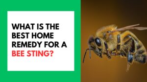 What Is the Best Home Remedy for A Bee Sting?