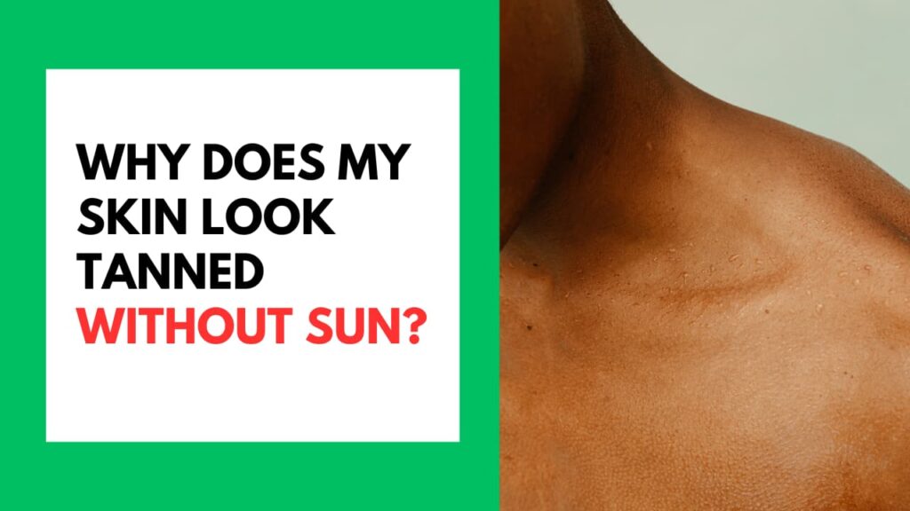 Why Does My Skin Look Tanned Without Sun? Why Does My Skin Look Tanned Without Sun Featured