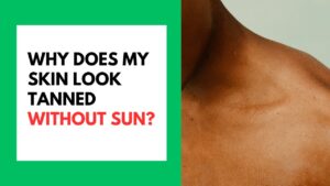 Why Does My Skin Look Tanned Without Sun Featured