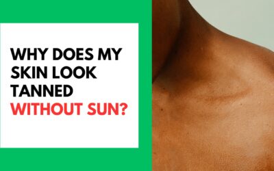 Why Does My Skin Look Tanned Without Sun? Why Does My Skin Look Tanned Without Sun Featured