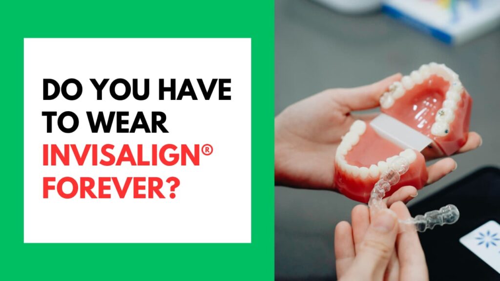 Do You Have to Wear Invisalign Forever